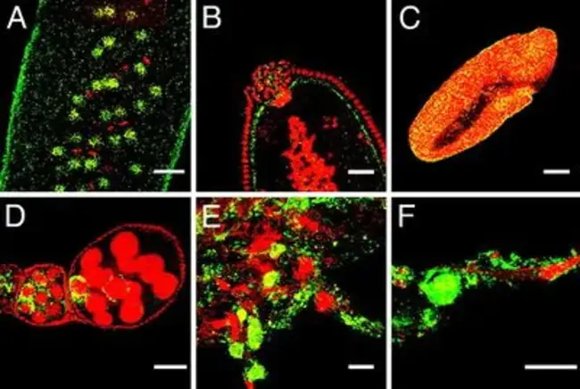Aucuba Bacilliform Virus : 奥克巴杆菌型病毒