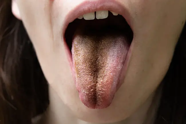 Tongue In Cheek : 舌颊