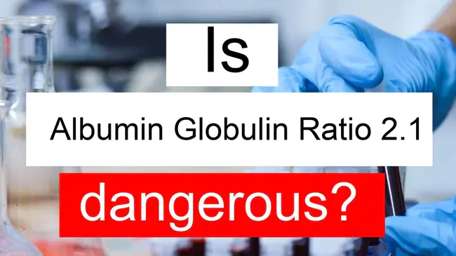 Albumin/Globulin ratio : 白蛋白-球蛋白比值