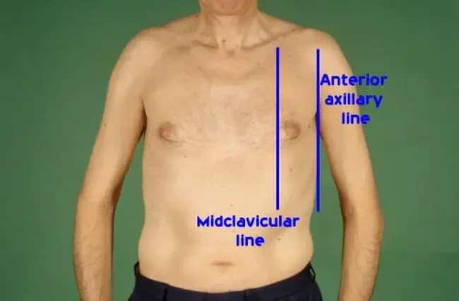 Anterior Axillary Line : 腋前线