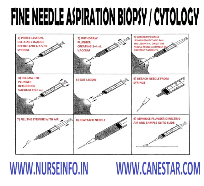 Aspiration, Biopsy, Cytology : 抽吸、活检、细胞学