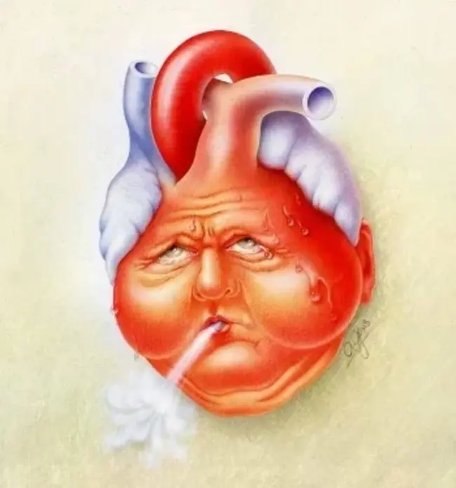 Congestive Heart Failure : 充血性心力衰竭