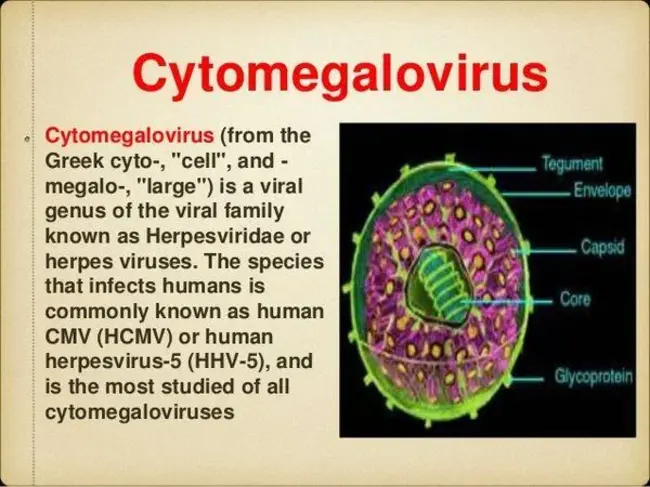 CytoMegalo Virus : 巨细胞病毒