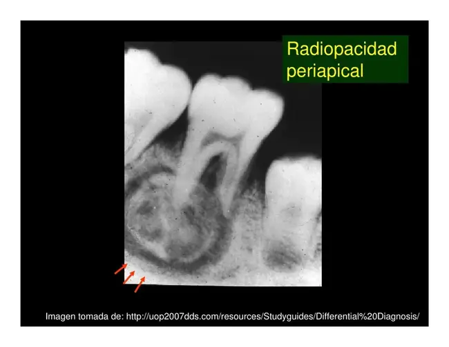 Differential Diagnosis : 鉴别诊断