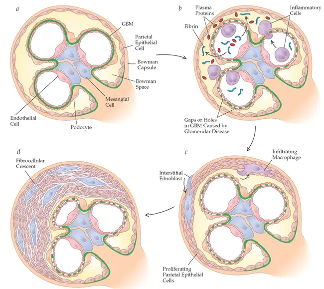 Glomerular Filtration Rate : 肾小球滤过率