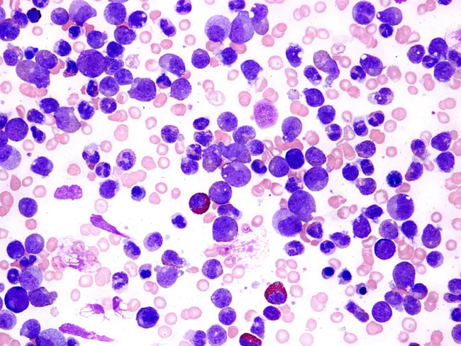 Leukaemia Research Fund : 白血病研究基金