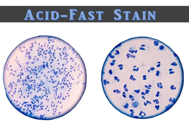 Acid-Fast : 耐酸碱