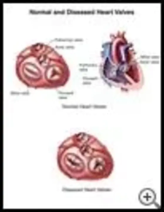 Aortic Flow : 主动脉血流