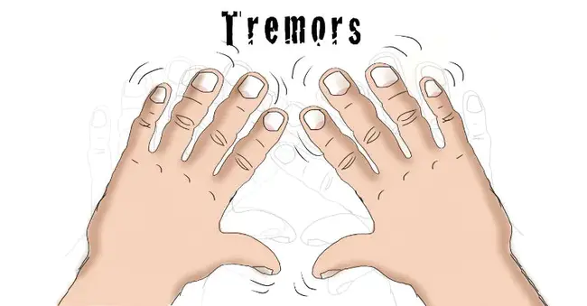 Tremor : 震颤