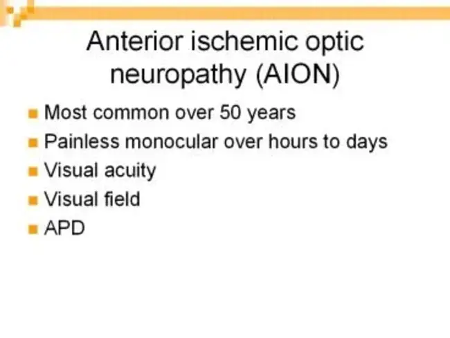 Anterior ischemic optic neuropathy : 前部缺血性视神经病变