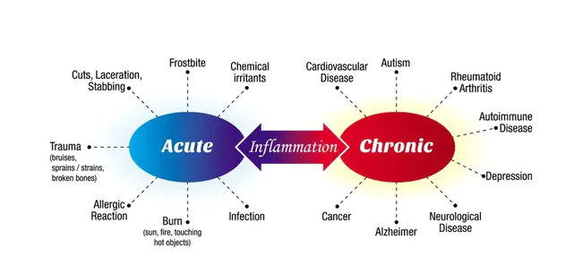 Acute Pulmonary Edema : 急性肺水肿