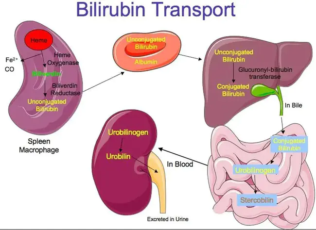 Bilirubin : 胆红素