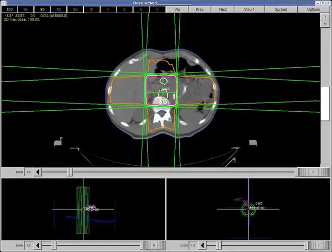 Advanced Neuromodulation Systems, Inc. : 高级神经调节系统公司