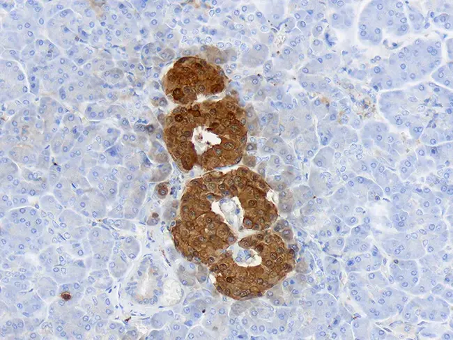 Neuron-Specific Enolase : 神经元特异性烯醇化酶