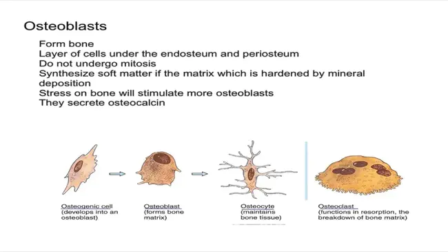 Osteogenic Sarcoma (bone tumors) : 骨源性肉瘤（骨肿瘤）