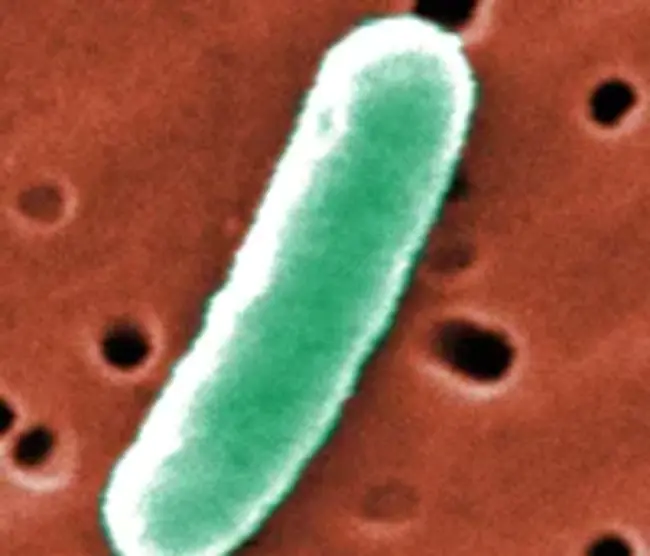 Enterotoxigenic Escherichia Coli : 肠毒性大肠杆菌