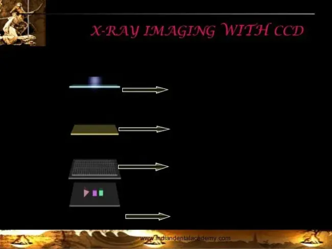 Digital Subtraction Angiography : 数字减影血管造影