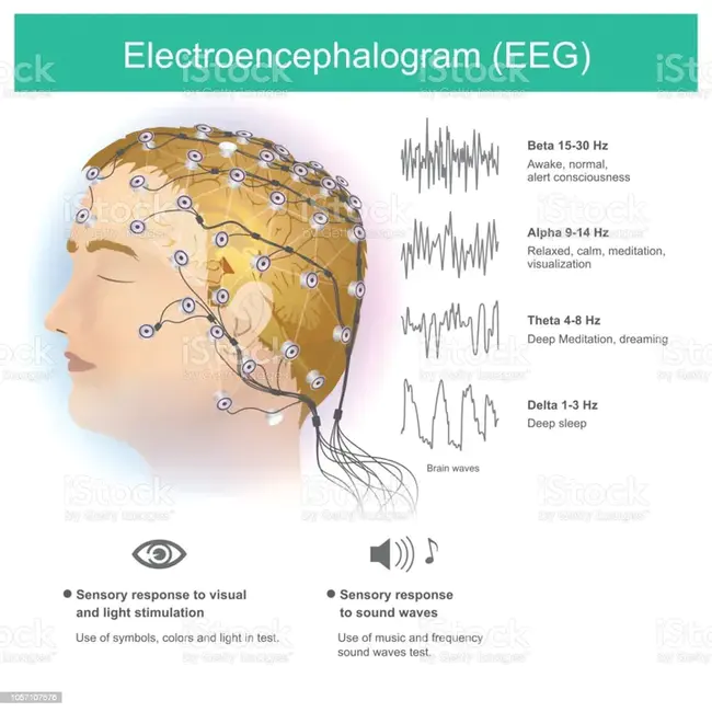 Electro-EncephaloGram : 脑电图