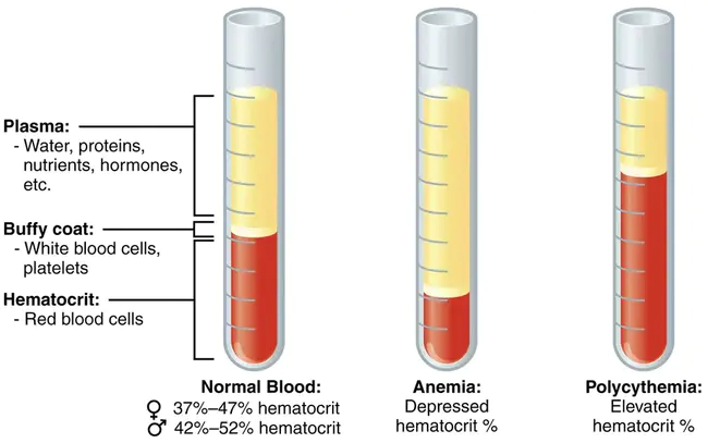 Hematocrit : 红细胞压积