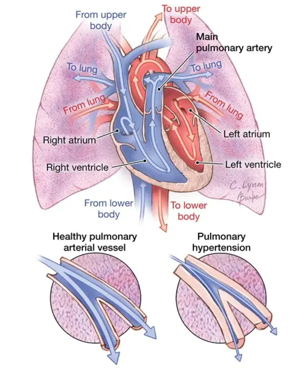 Pulmonary Function Test : 肺功能试验