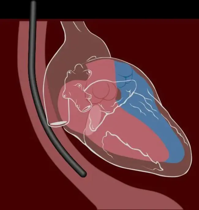 TransEsophageal Echocardiography : 经食管超声心动图