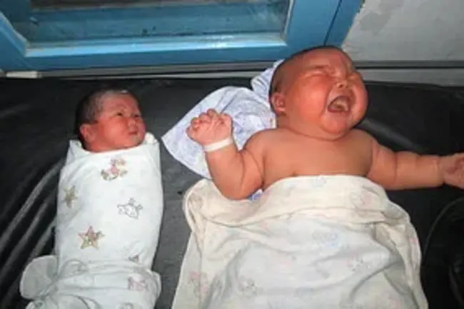 Birth Weight : 出生体重