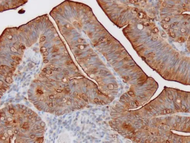 CarcinoEmbryonic Agent : 癌胚剂