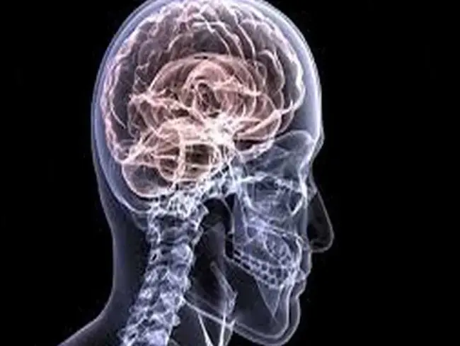 Neurologic Examination : 神经系统检查