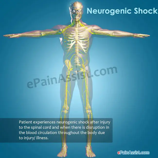 Neurogenic Muscular Atrophy : 神经源性肌肉萎缩