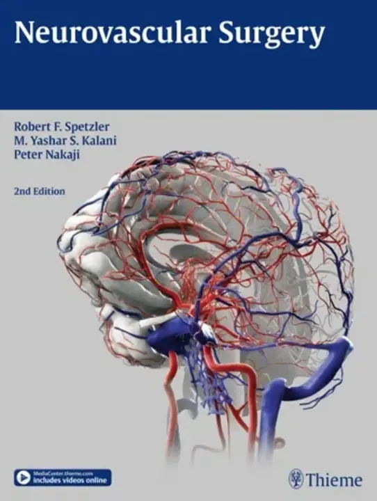 NeuroVascular : 神经血管的