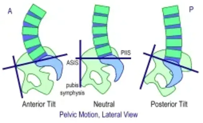 Posterior Anterior : 后前