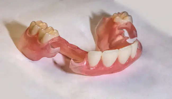 Partial Denture : 部分义齿