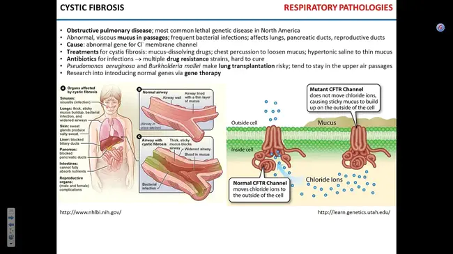 Pulmonary Disease : 肺疾病