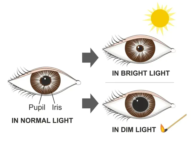 Pupillary Light Reflex : 瞳孔光反射