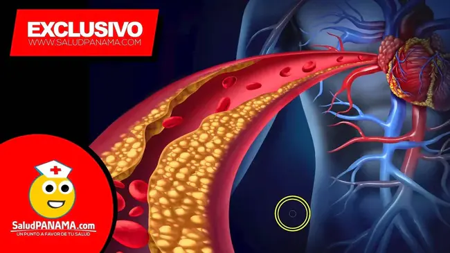 Cerebro-Vascular Accident : 脑血管意外