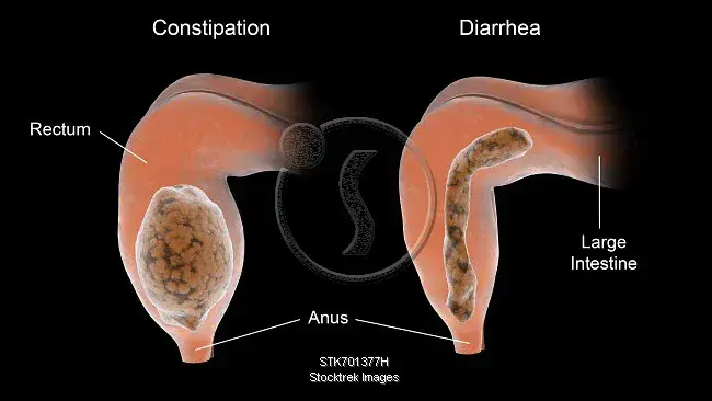 Diarrhea/Constipation : 腹泻/便秘