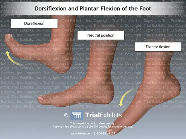 Dorsi-HyperFlexion : 背屈过度