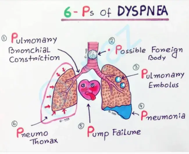 Dyspnea On Exertion : 运动时呼吸困难