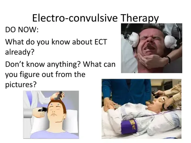 Electro-Convulsive Therapy : 电抽搐疗法