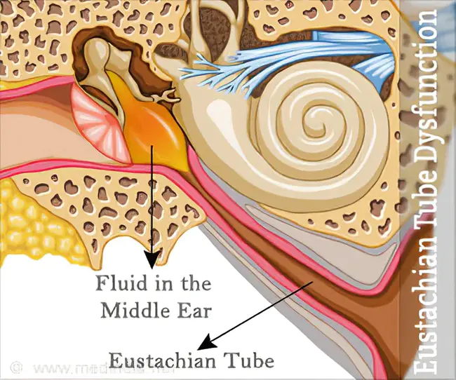Eustachian Tube Function : 咽鼓管功能