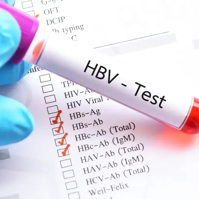 Hepatitis Associated Antibodies : 肝炎相关抗体