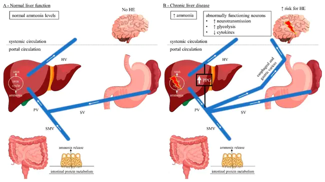 Hepatic blood flow : 肝血流