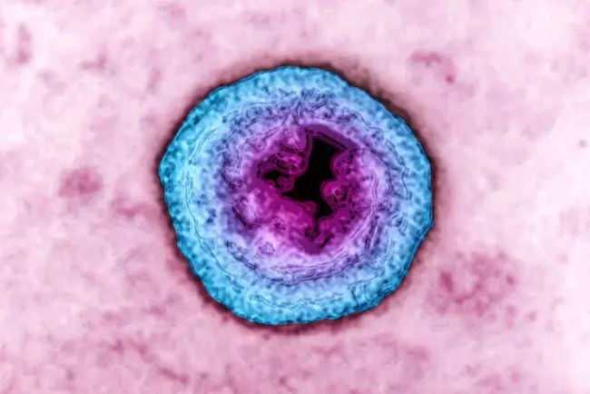 Herpes Virus : 疱疹病毒
