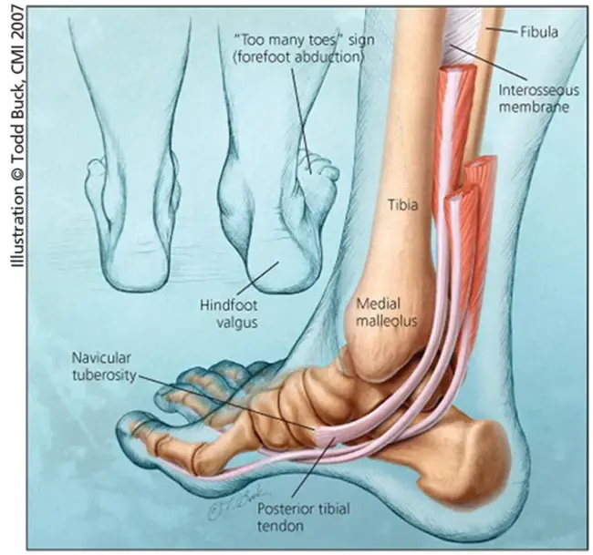 Posterior Tibial pulse : 胫骨后脉