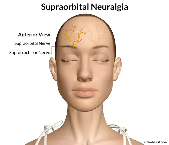 Supraorbital : 眶上的