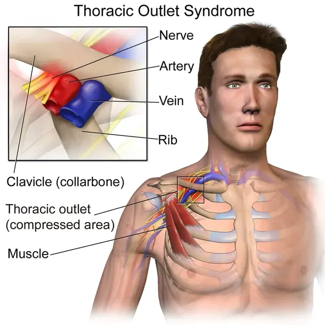 Thoracic : 胸廓