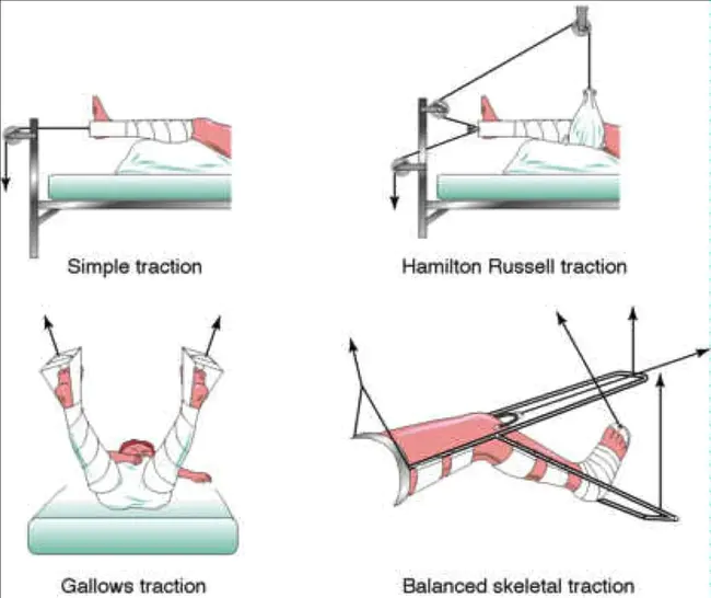 Traction : 牵引