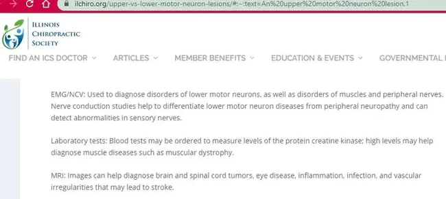 Upper Motor Neuron Lesion : 上运动神经元病变