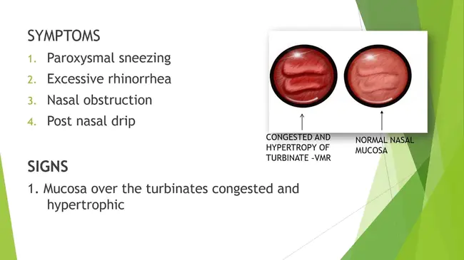 VasoMotor Rhinitis : 血管舒缩性鼻炎