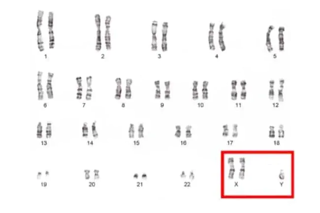 Male Sex Chromosome : 男性性染色体